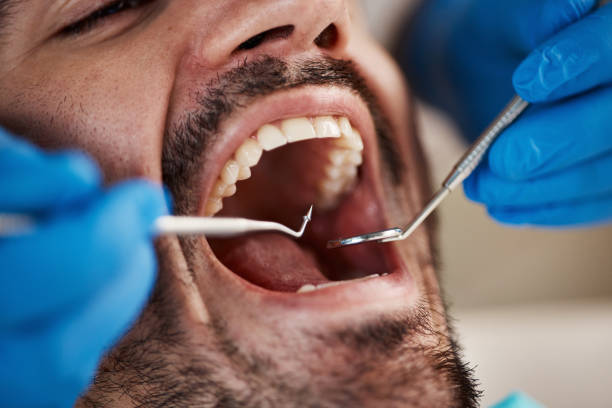 Emergency Dental Services in St Robert, MO